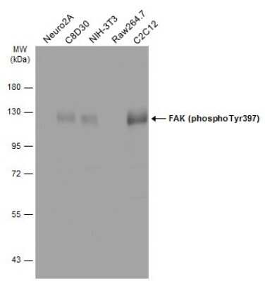 Western Blot: FAK [p Tyr397] Antibody [NBP3-12897]